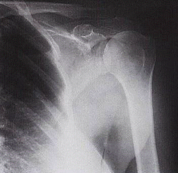 Diagrama Posición 1